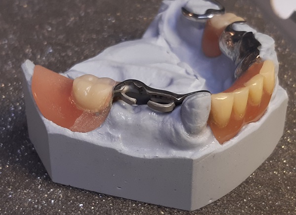 AOM dd44,45 lisäys, kahdella hitsatulla vahvikkeella 